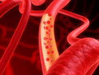 risks of low cholesterol